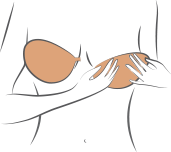 Care step2 figure1